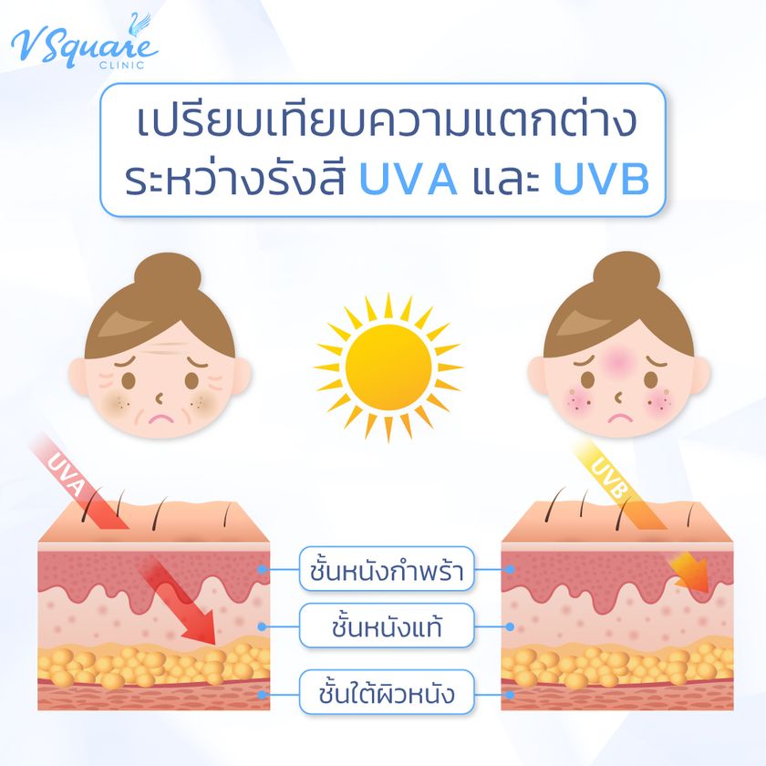 ความแตกต่างรังสี-UVA-และ-UVB