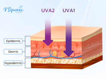 UVA 1 และ UVA 2 คือ ต่างกันอย่างไร 370x277