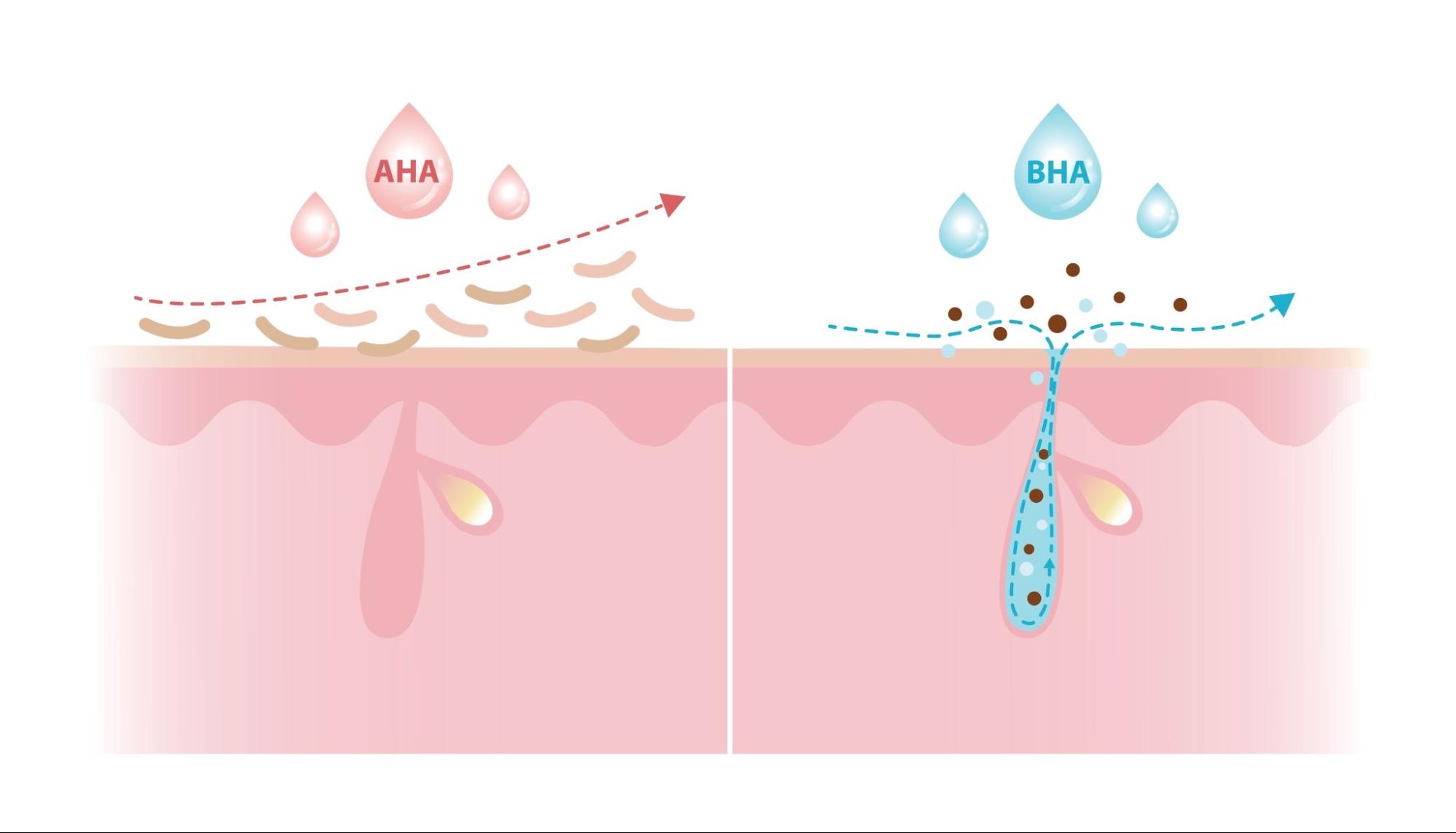 Bha Rashed AHA & BHA คืออะไร ? ต่างกันอย่างไร ? ใช้ตัวไหนแล้วผิวขาวใส