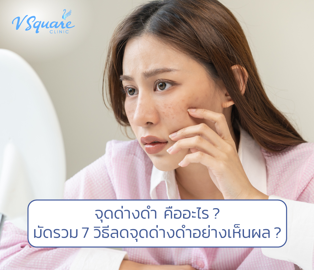 7 วิธีลดจุดด่างดำ