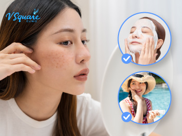 7 วิธีลดจุดด่างดำบนใบหน้าแบบธรรมชาติ 370x277