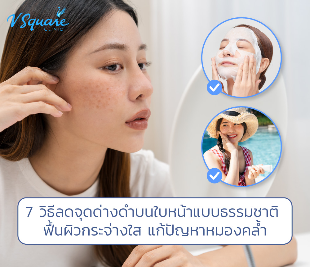 7 วิธีลดจุดด่างดำบนใบหน้าแบบธรรมชาติ