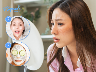แก้หน้าหมองคล้ำเร่งด่วน 370x277