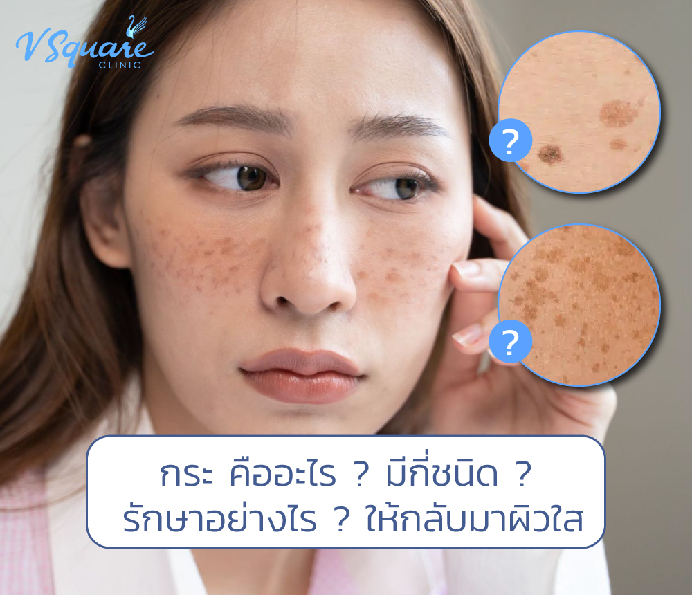 กระ