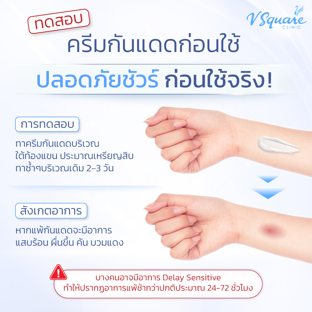 ทดสอบการแพ้ไฮยาลูรอน