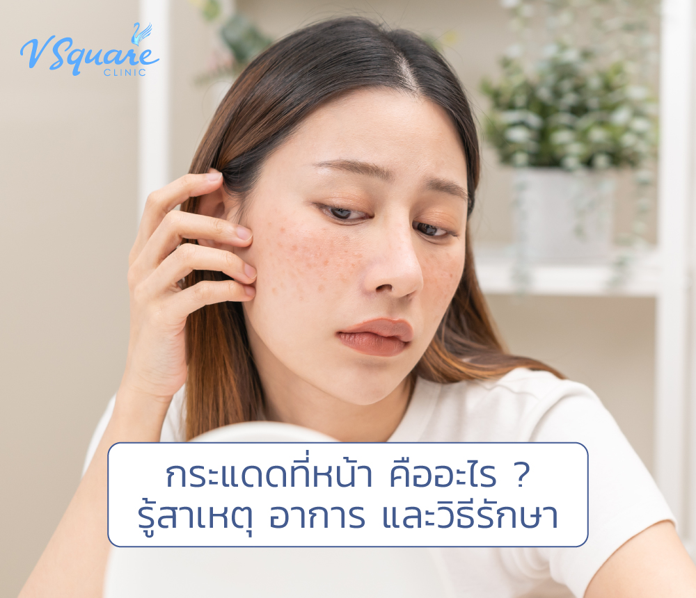 กระแดดที่หน้า