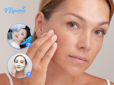 รักษากระแดด 370x277